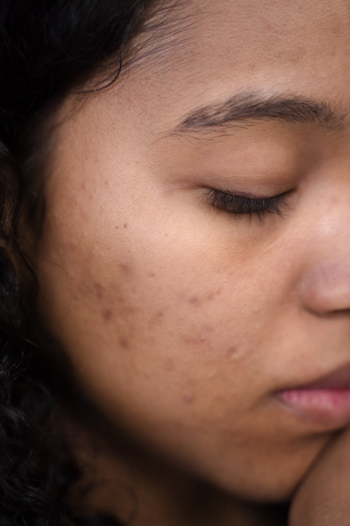 How to Choose a Hydrating Oil-Free Moisturizer - Sente Labs