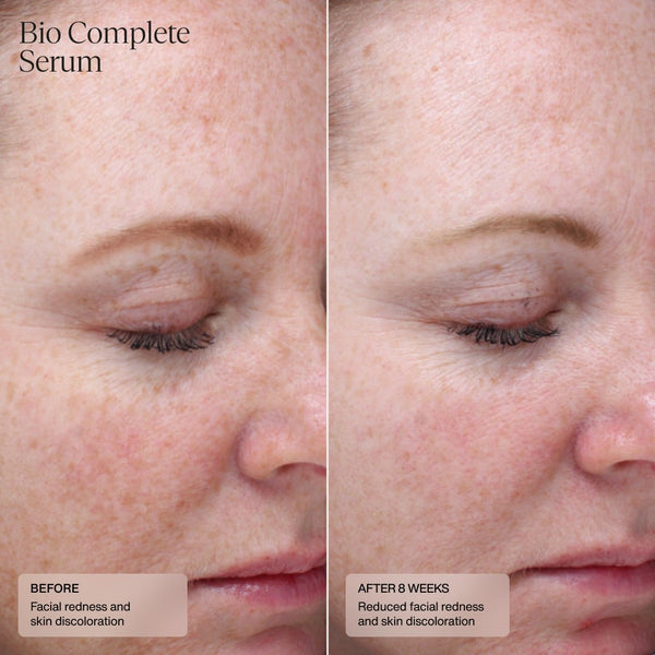 Bio Complete Serum - Sente Labs-Treat