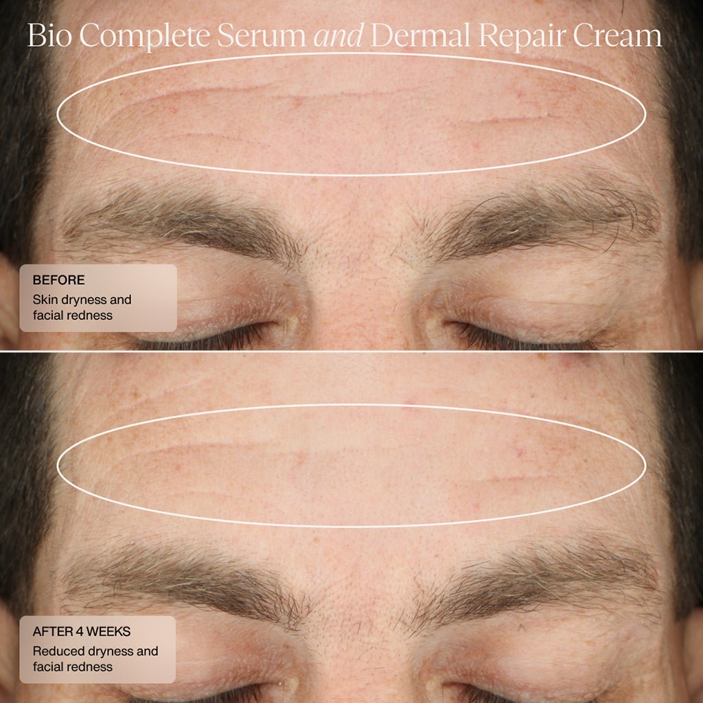 Bio Complete Serum - Sente Labs-Treat