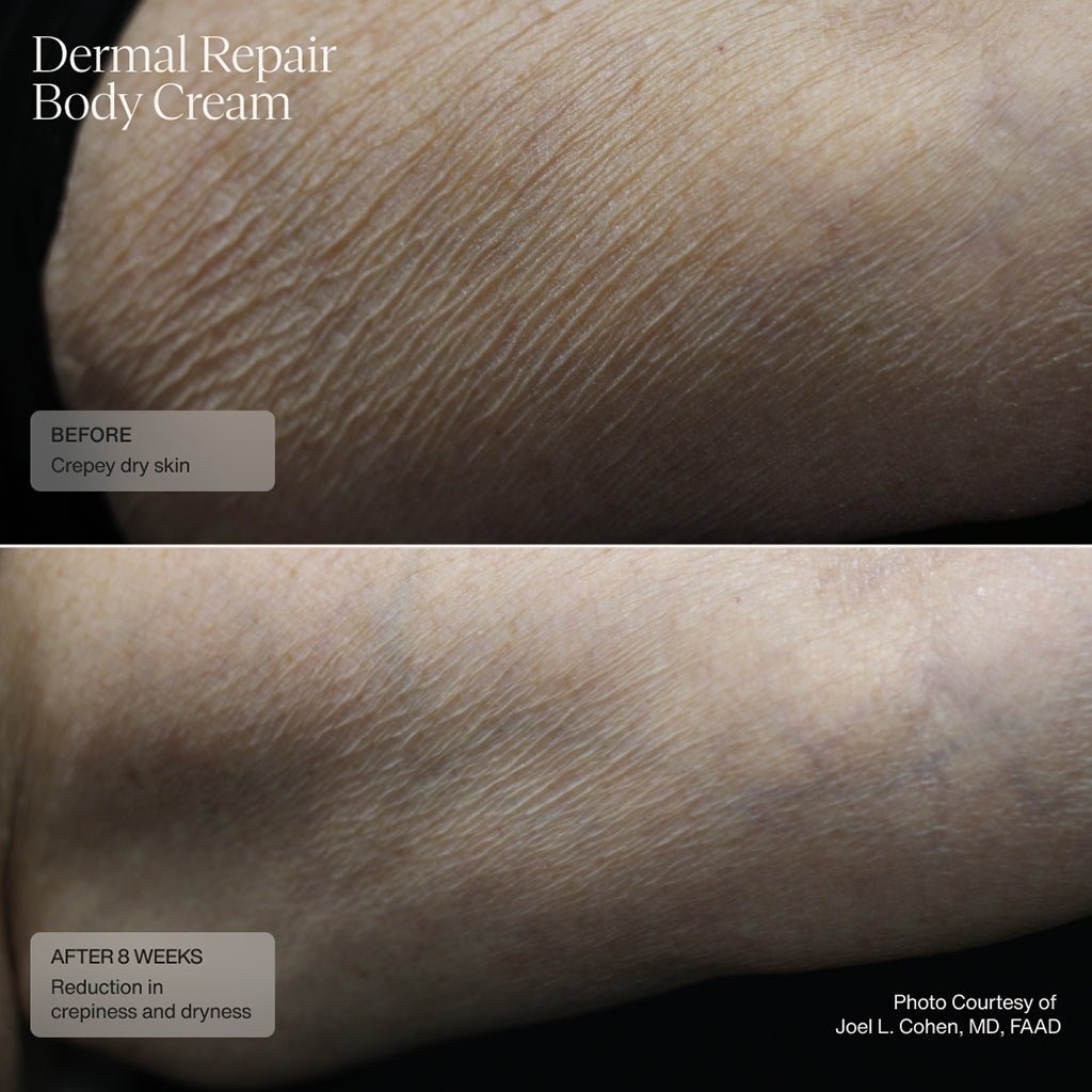 Dermal Repair Body Cream - Sente Labs-