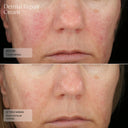 Dermal Repair Cream - Sente Labs-Treat