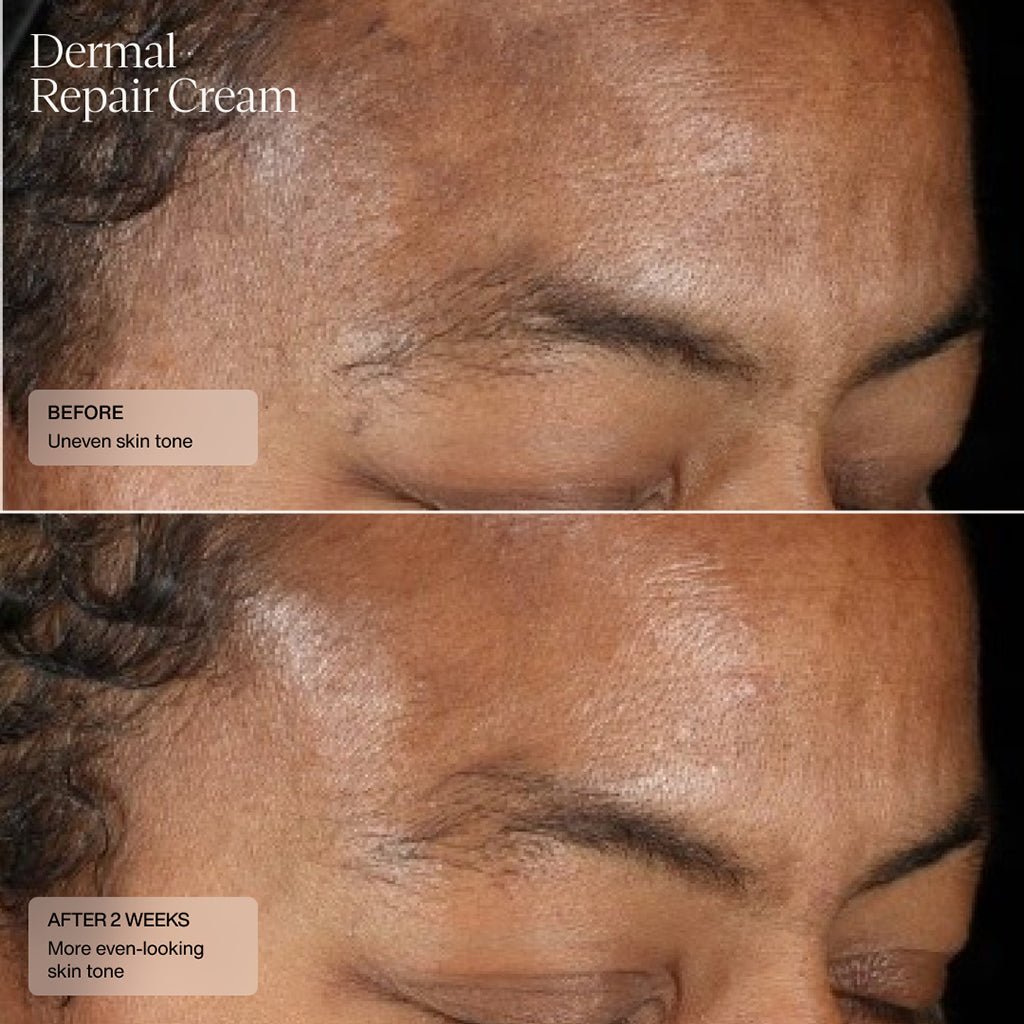 Dermal Repair Cream - Sente Labs-Treat