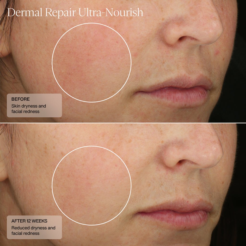 Dermal Repair Ultra-Nourish - Sente Labs-Treat