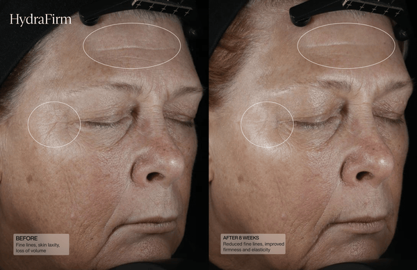 HydraFirm (Dermal Contour Pressed Serum) - Sente Labs-Treat