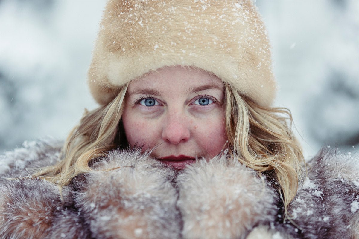 3 Ways to Improve Hyperpigmentation in the Winter - Sente Labs