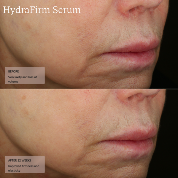 HydraFirm Serum