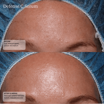 Defense C Serum - Sente Labs - Skin Care