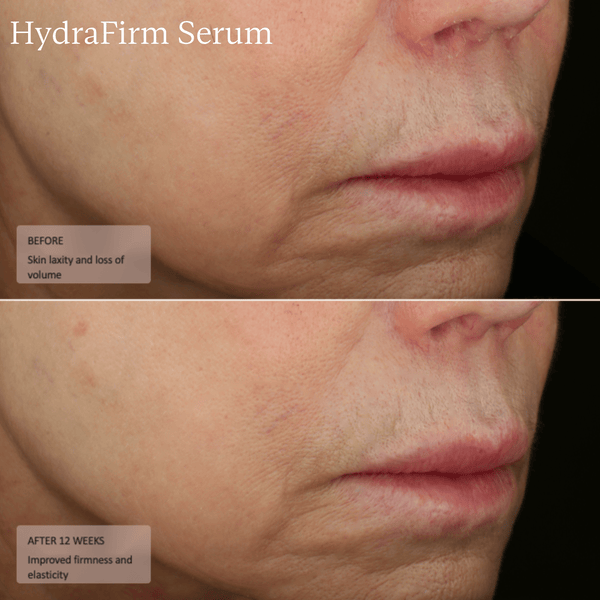 HydraFirm Serum - Sente Labs-Treat