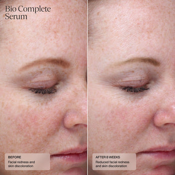 Bio Complete Serum - Sente Labs-Treat