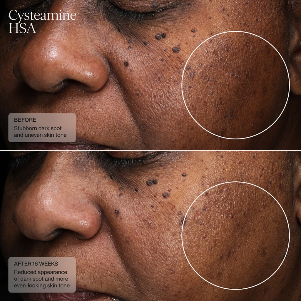 Cysteamine HSA Pigment & Tone Corrector - Sente Labs-Skin Care