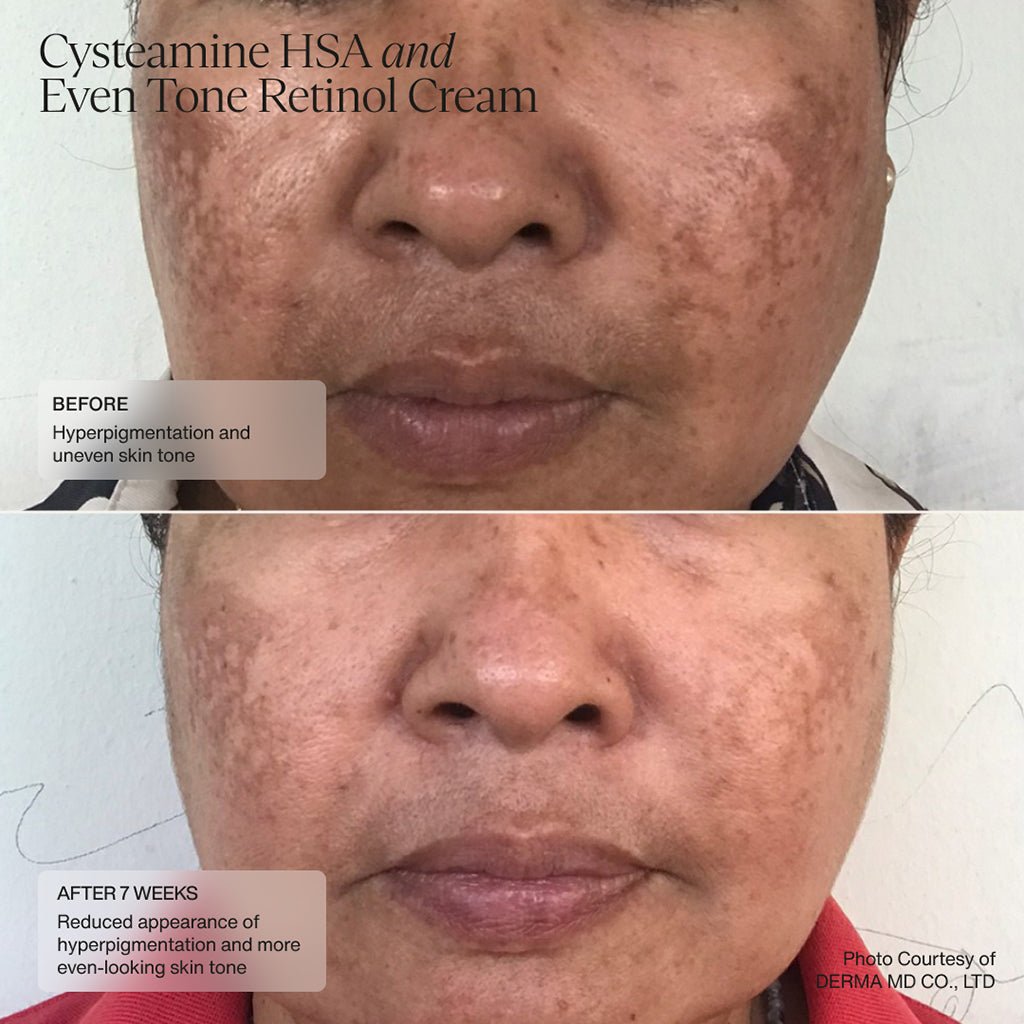 Cysteamine HSA Pigment & Tone Corrector - Sente Labs-Skin Care