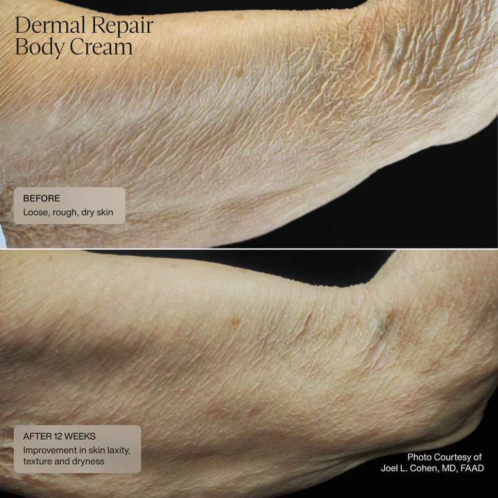 Dermal Repair Body Cream - Sente Labs-