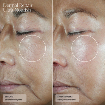 Dermal Repair Ultra-Nourish - Sente Labs-Treat